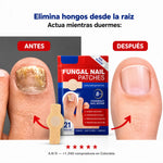 Parches MicoDerm®