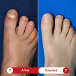 Parches MicoDerm®