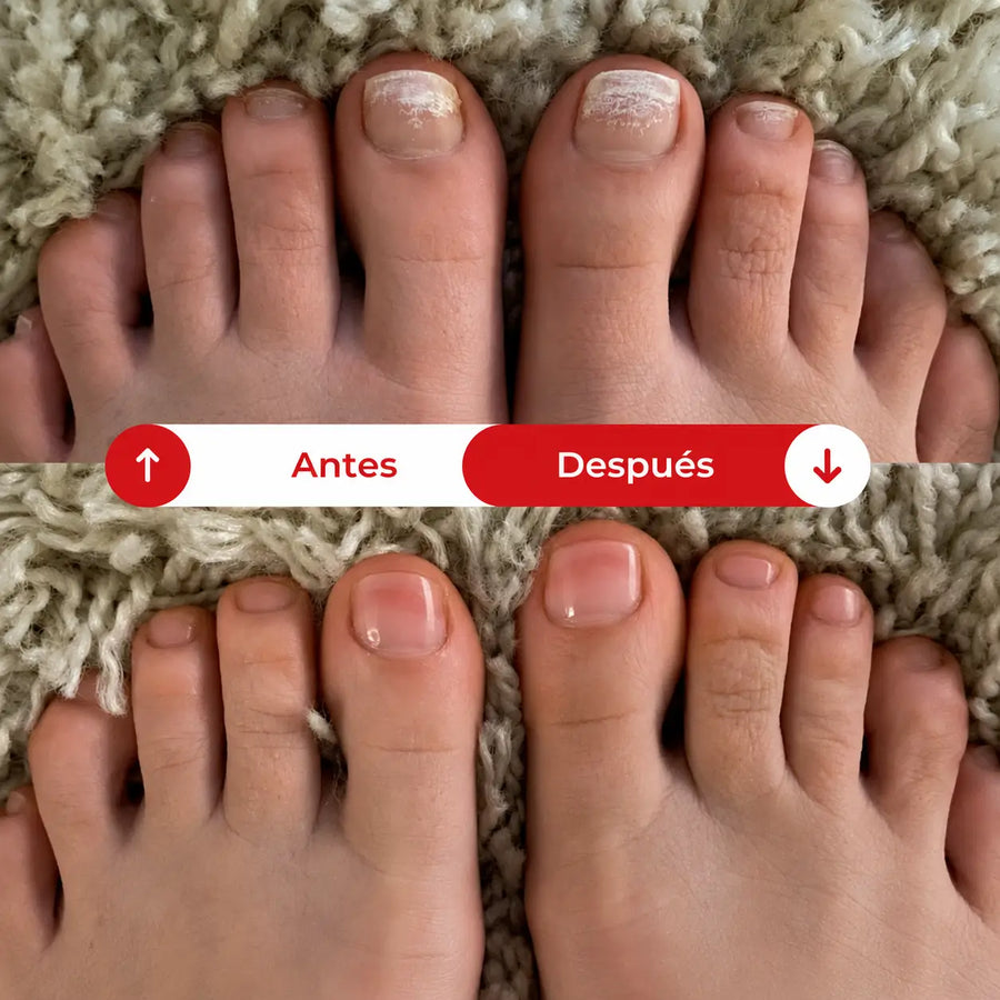 Parches MicoDerm®